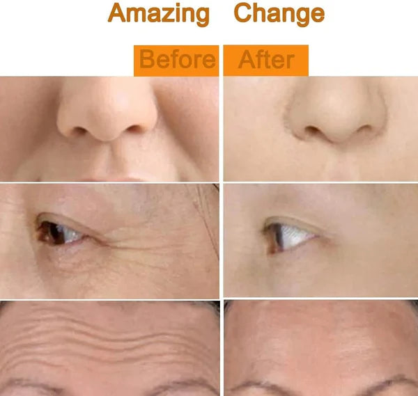 Golden Energy Face Massager