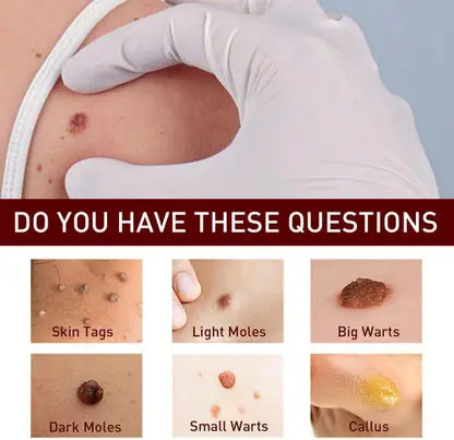 TAGS & MOLES REMOVER