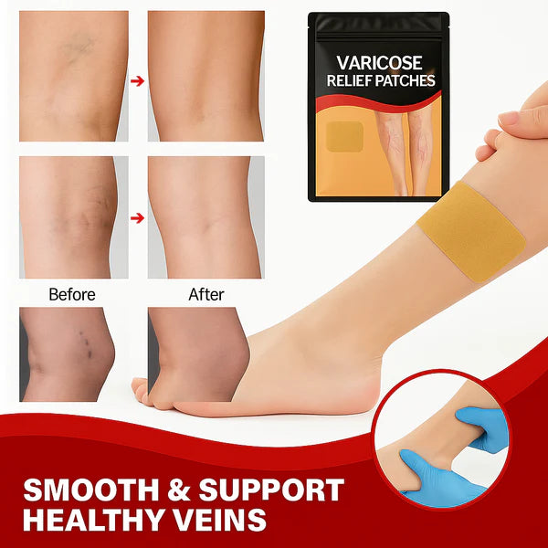 Varicose vein Patches - Pack of 10
