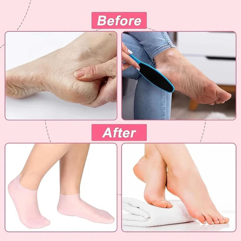 Gel Spa Moisturizing Socks for Cracked Heels | Soft Repair Socks | Deep Hydrating Foot Care for Men & Women