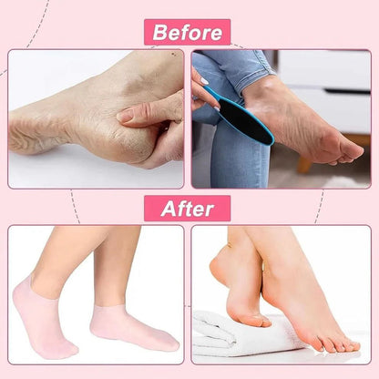 Gel Spa Moisturizing Socks for Cracked Heels | Soft Repair Socks | Deep Hydrating Foot Care for Men & Women